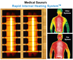 Medical Sauna Review